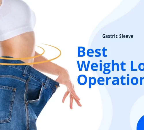 best weight loss operation Gastric Sleeve surgery