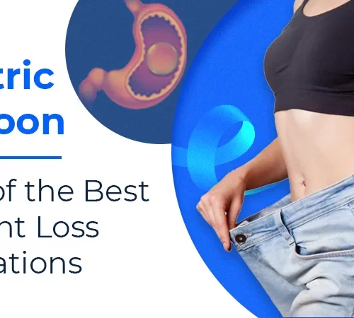 gastric-balloon-surgery Gastric Balloon-surgery