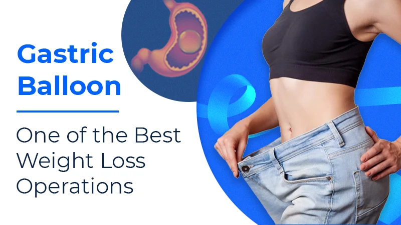 Gastric Balloon-surgery