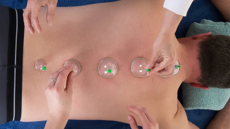 sırtına hacamat yapılan erkek hasta