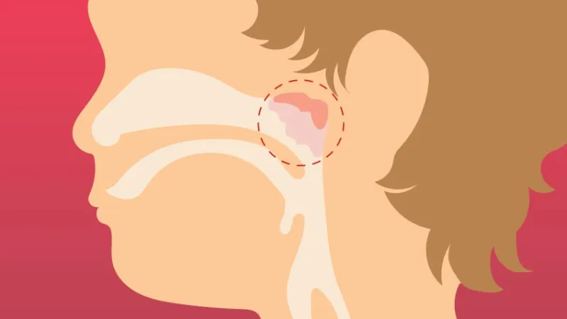 geniz eti görüntüsü