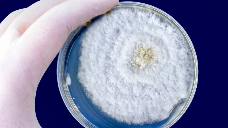 Kara mantar hastalığı (Mukormikoz) tanısı