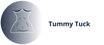 Tummy Tuck