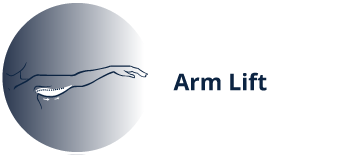 Arm Lift