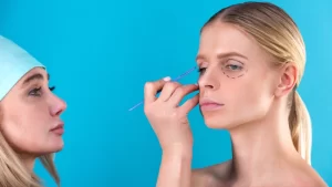 Blefaroplasti (Göz kapağı estetiği) ameliyatı öncesi