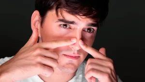 Erkek burun estetiği ameliyatı olan genç