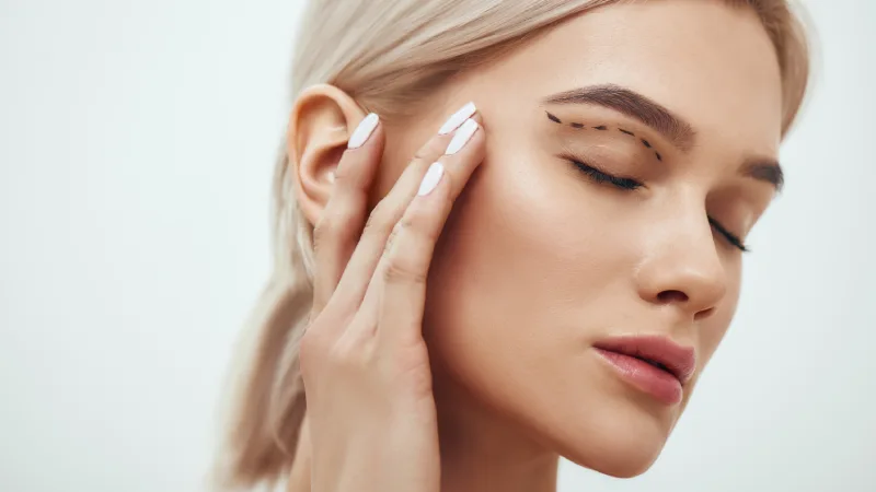 göz kapağı düşüklüğü ameliyatı olan kadın