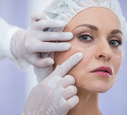 Mini Face Lift Ameliyatı