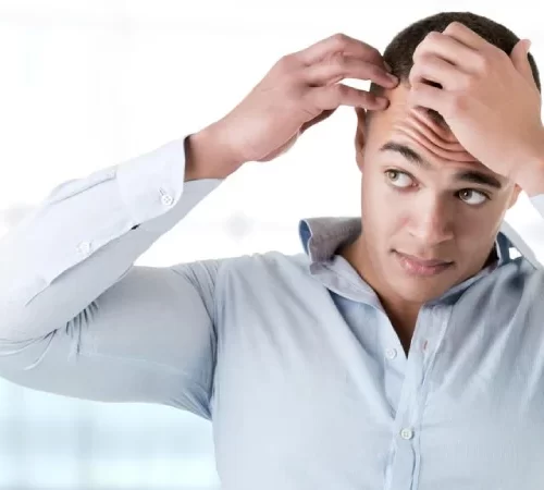 saç ekimi sonrası kabuklanma yaşayan erkek