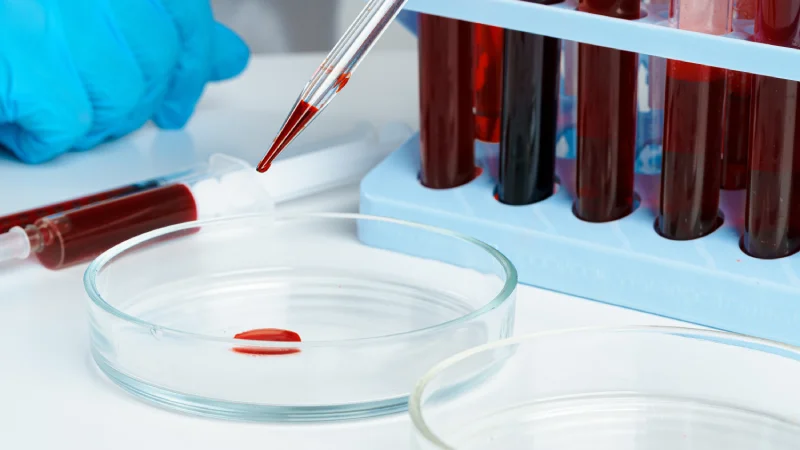 şeker yüklemesi zararlı mi kanda şeker ölçümü