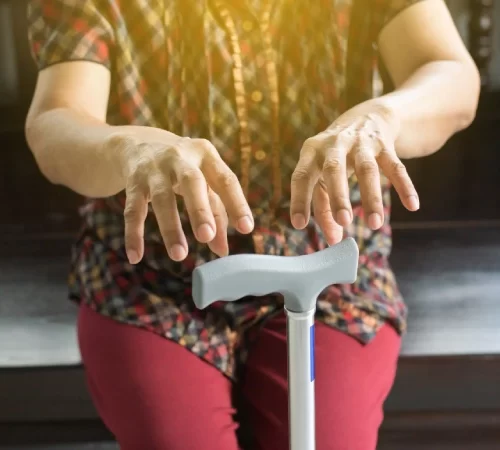 Tremor (Titreme hastalığı) belirtileri taşıyan kadın
