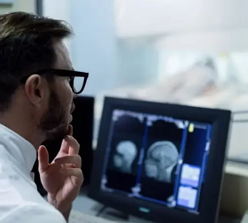 bt anjiyo türleri anjiyografi sonuçları inceleyen doktor