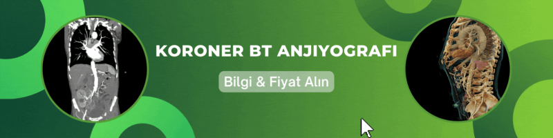 BT Anjiyografi için Bilgi ve Fiyat Alın