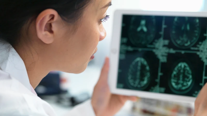 koroner bt anjiyografi nasıl çekilir bt anjiyo sonuçları inceleyen doktor