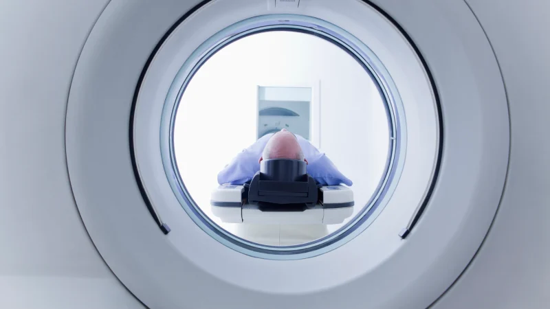 koroner bt anjiyografi neden yapılır bt anjiyo makinesindeki hasta