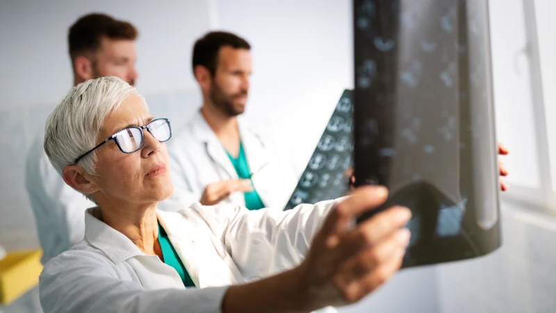 koroner bt anjiyografi öncesi beslenme anjiyografi sonucu inceleyen doktor