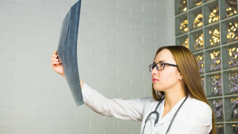 Beyin MR ile Hangi Hastalıklar Teşhis Edilir? mr röntgeni inceleyen doktor