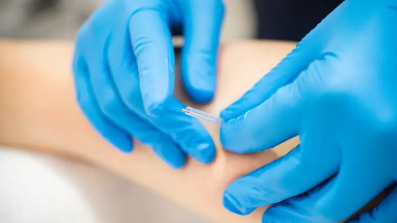 kuru iğneleme acıtır mı kuru iğne yapılan hasta