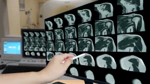 Lomber MR hangi durumlarda yapılır