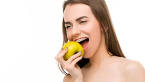 Damon Sistem ile Diş Teli Tedavisi uygulanan kadın