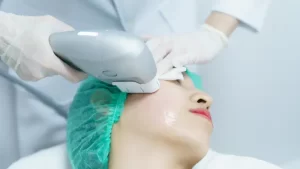 hifu ameliyatsız yüz germe yapılan kadın