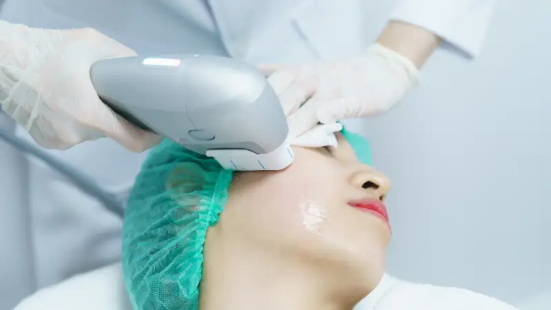 hifu ameliyatsız yüz germe yapılan kadın