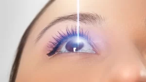 İki Kez Lazer Göz Ameliyatı olan kadın