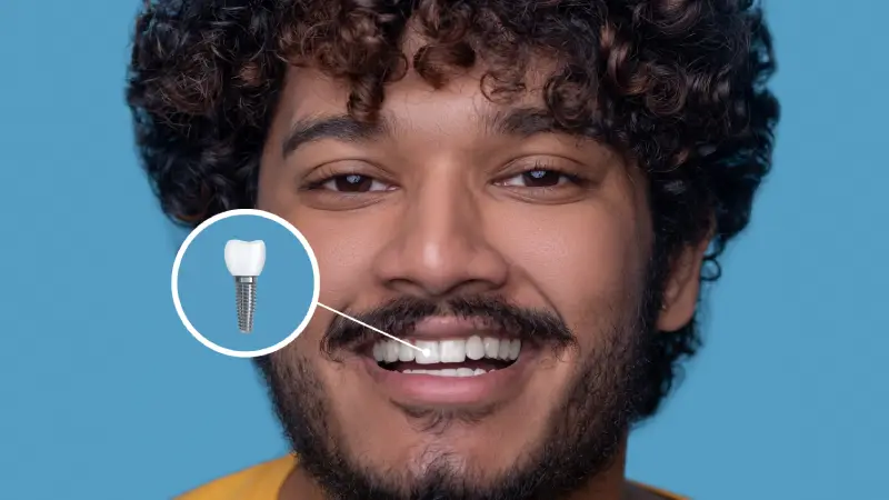 implant tedavisi ne kadar sürer