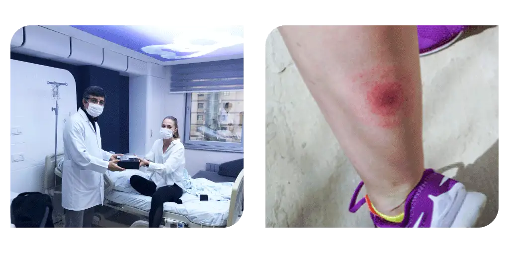 lyme hastalığı