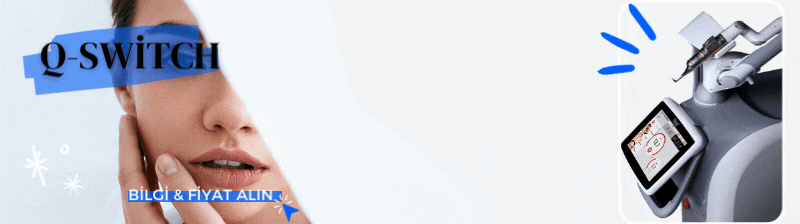 Q-switch Hakkında Bilgi ve Fiyat Al