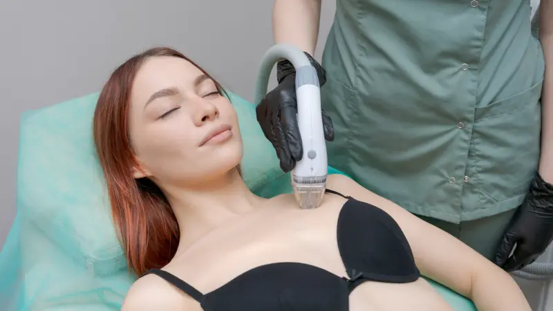 hifu öncesi yapılması gerekenler hifu uygulanan kadın