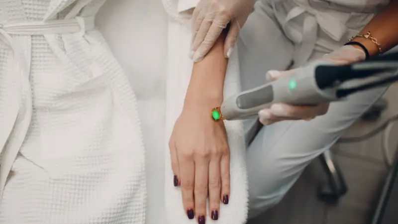 Leke tedavisinde Q-switch Lazer uygulanan kadın