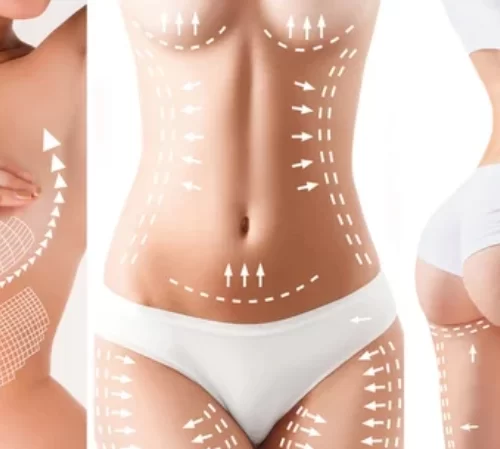 body-lift-n Body Lift