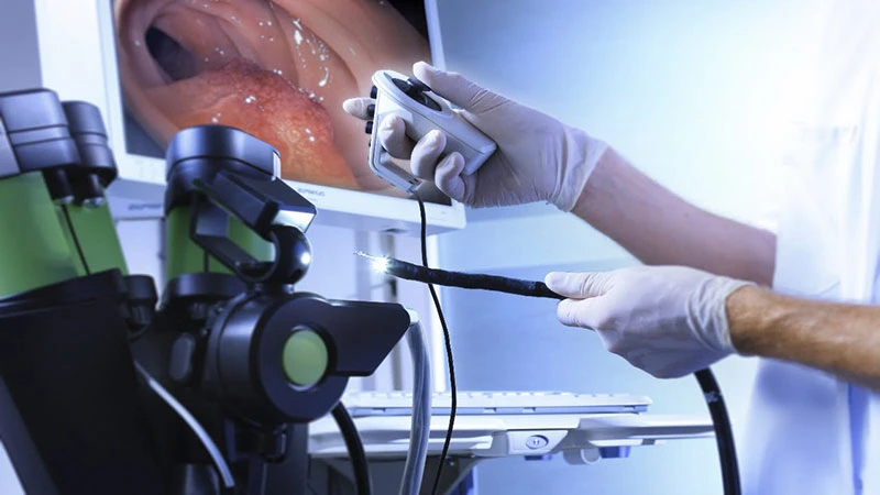 Endoskopi Faydaları