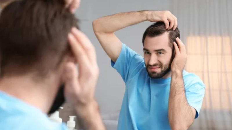 hair transplant