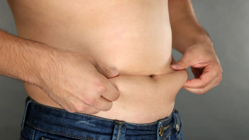 Tummy tuck