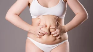 Post Bariatrik Operasyonlar