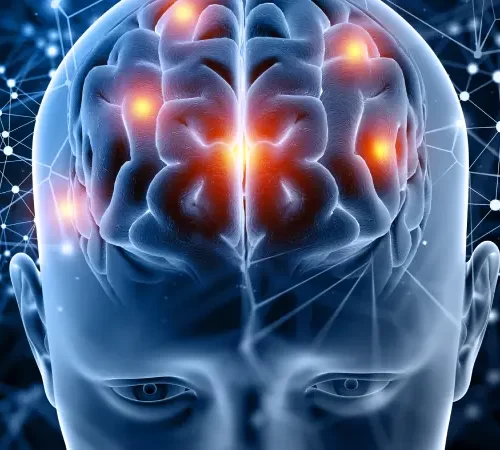 Deep Brain Stimulation