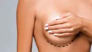 breast aesthetics after weight loss