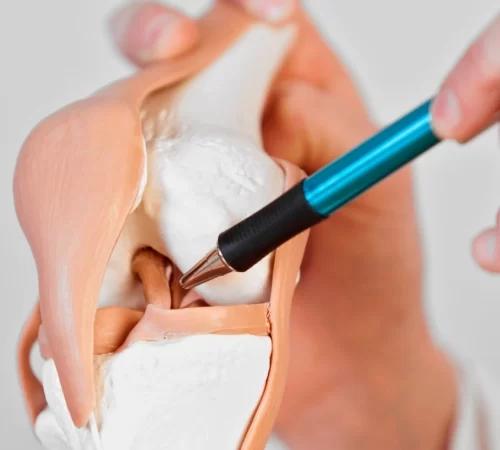 Ön Çapraz Bağ Yaralanması