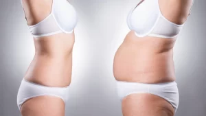 Kilo Verme Sonrası Estetik Ameliyatları