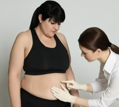 Bariatrik Cerrahi Sonrası Dikkat Edilmesi Gerekenler