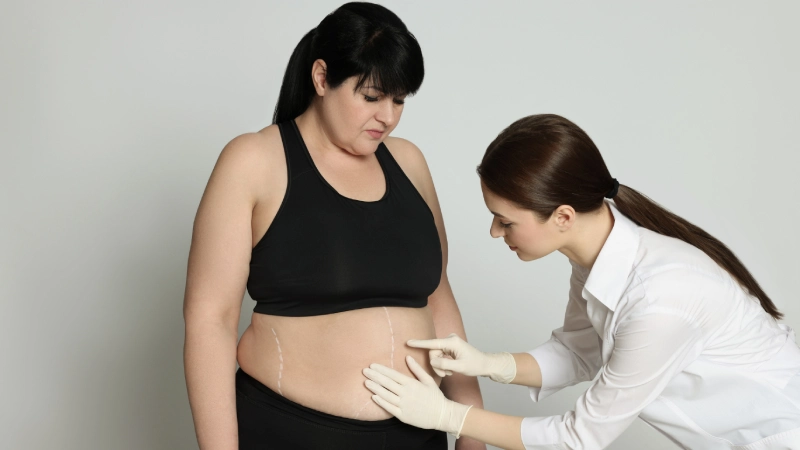 Bariatrik Cerrahi Sonrası Dikkat Edilmesi Gerekenler