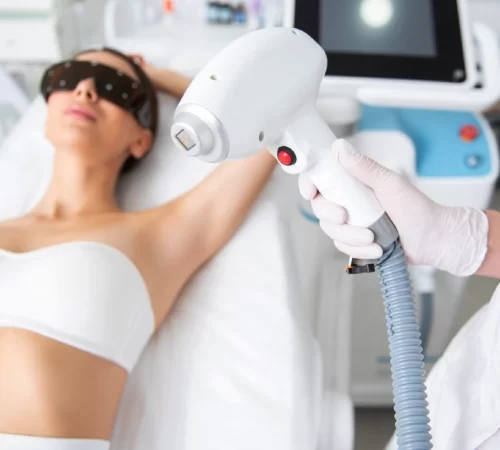 Lazer Epilasyon Çeşitleri- lazer epilasyon cihaz başlığı