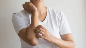 Kaşıntı Sebepleri?- Kolu kaşınan kadın