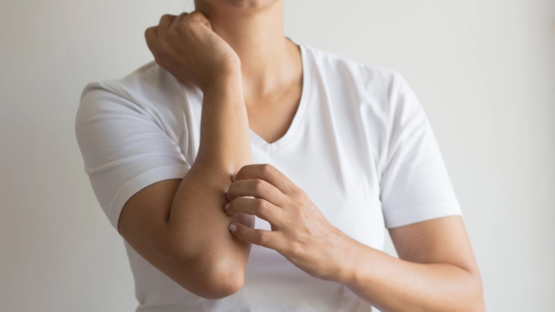 Kaşıntı Sebepleri?- Kolu kaşınan kadın
