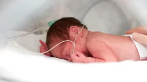 Nöral Tüp Defekti ve Nöroşirürji- kablolara bağlı hasta yenidoğan