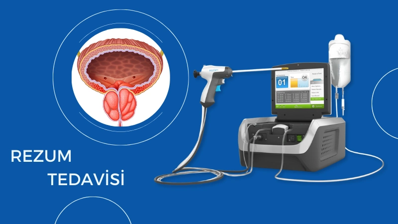 Prostat Büyümesinde Etkili Tedavi: REZUM- prostat cihazı ve prostat