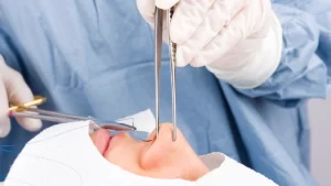 Transsphenoidal (Endoskopik) Hipofiz Cerrahisi- ameliyat anı