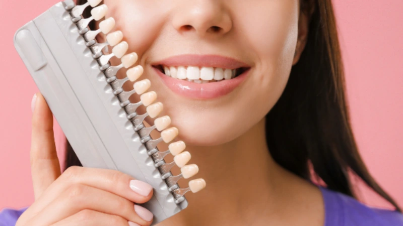 Diş kaplama Fiyatları 2023- diş kaplama seçen kişi